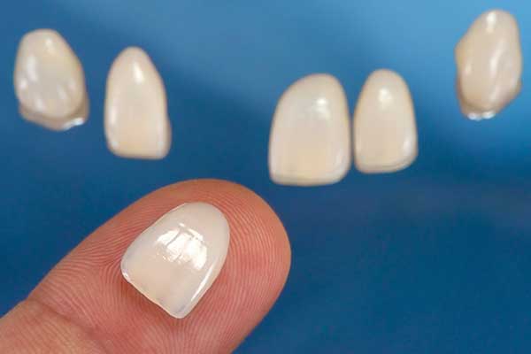 Tooth shade guide being held up to teeth