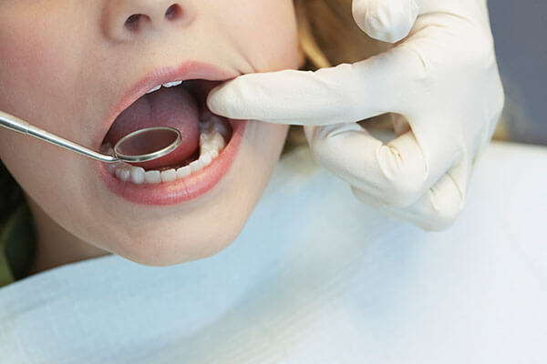 Sealants