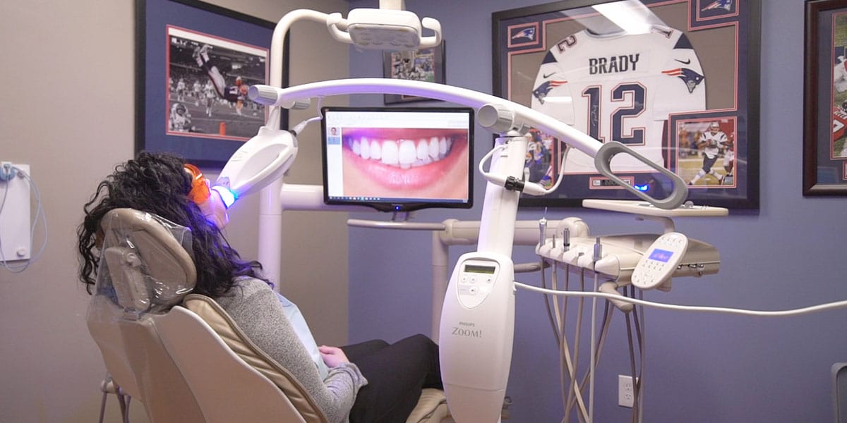 Before and After Image of Whitened Teeth