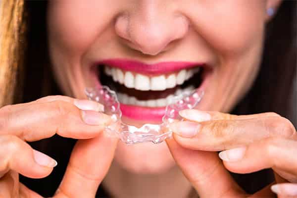 Mouth Guard
